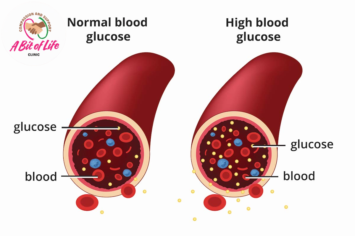 Normal blood glucose compared with high blood glucose