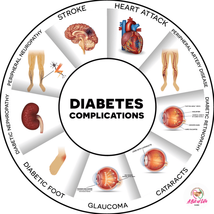 Diabetes complications overview