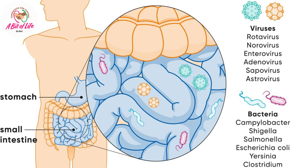 Common gastrointestinal infection pathogens